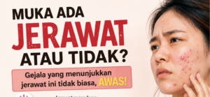 Pesakit mengalami jerawat meradang mendapatkan pemeriksaan doktor di Klinik VS Johor.