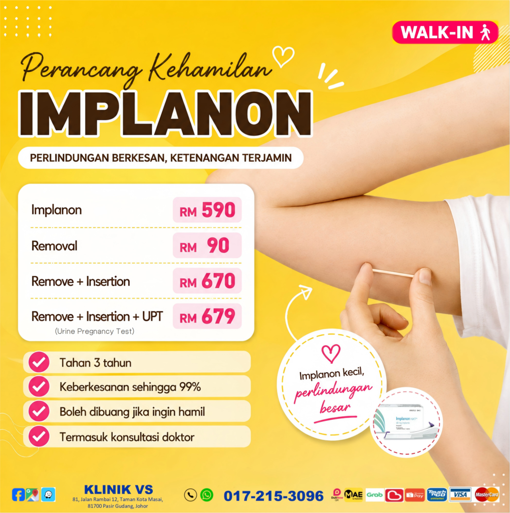 perancang keluarga Implanon di Klinik VS Johor.