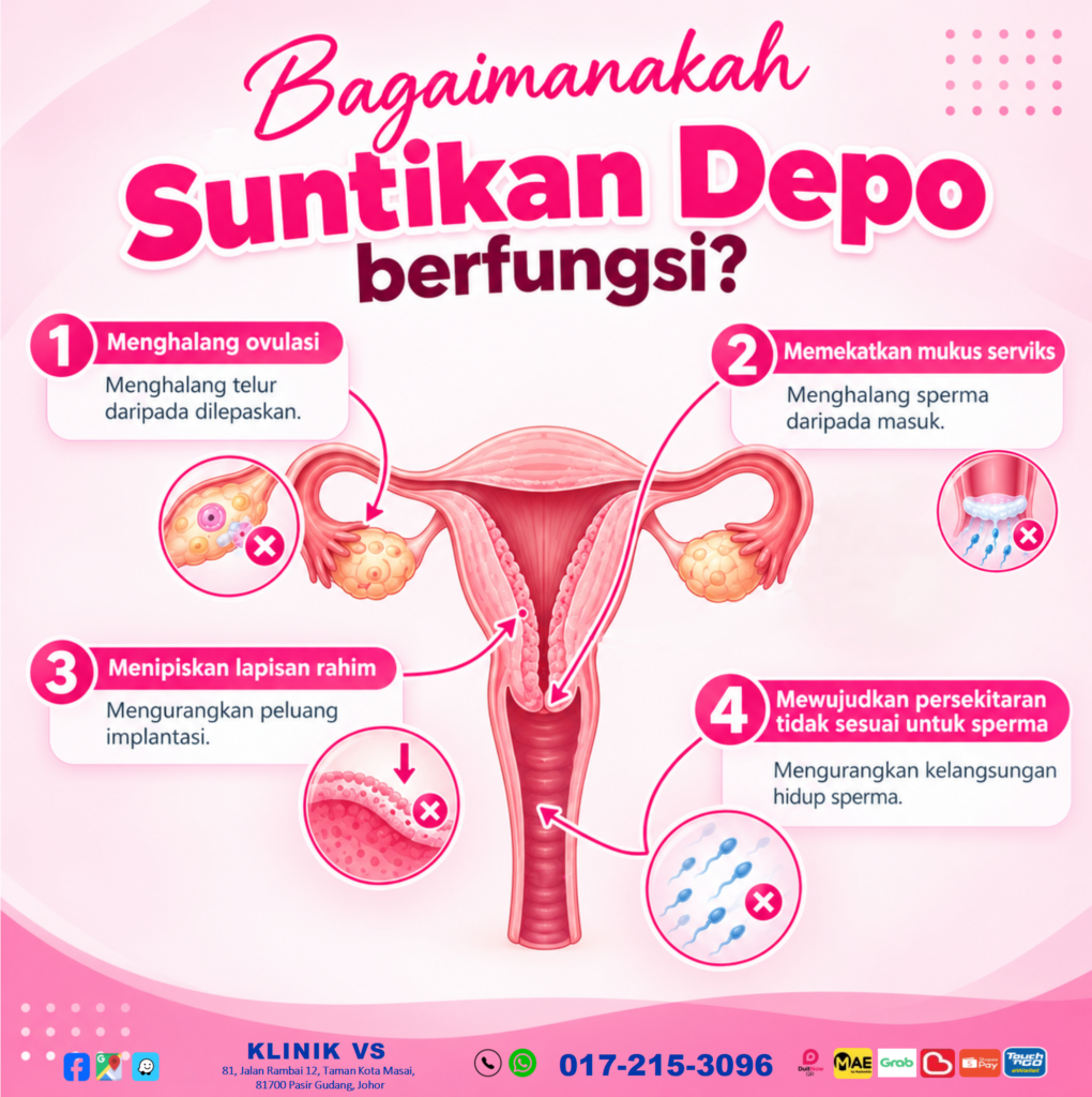Cara kerja Suntikan Depo untuk mencegah kehamilan di Johor